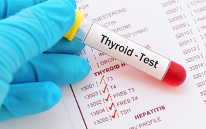  總及游離三碘甲狀腺原氨酸（TT3及FT3）-磁微粒化學(xué)發(fā)光法（AE/AP）/熒光免疫層析解決方案（雙抗體夾心法）