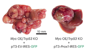 《Nature Genetics》PROX1積極抑制細(xì)胞命運(yùn)可塑性，保護(hù)肝細(xì)胞身份，防止肝腫瘤發(fā)生