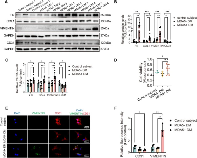 MDA5陽(yáng)性皮肌炎患者血清可誘導(dǎo)原代小鼠肺微血管內(nèi)皮細(xì)胞發(fā)生內(nèi)皮-間質(zhì)轉(zhuǎn)化