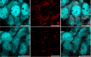 重大發(fā)現(xiàn)！阿爾茨海默病患者來源的高分子量 tau 蛋白如何 “破壞” 海馬神經(jīng)元？