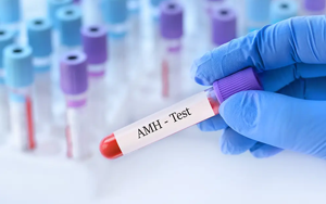 抗繆勒管激素（AMH）-磁微?；瘜W發(fā)光法（AE/AP） +熒光免疫層析解決方案