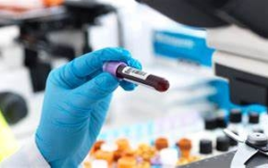 【FAPGG】，血管緊張素轉(zhuǎn)換酶檢測用底物