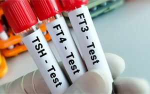 總及游離甲狀腺素（TT4及FT4）-磁微?；瘜W發(fā)光法（AE/AP）解決方案（雙抗體夾心法）