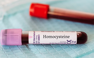 同型半胱氨酸（HCY）-磁微?；瘜W(xué)發(fā)光法（AE/AP） +熒光免疫層析解決方案