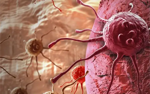 超級(jí)增強(qiáng)子導(dǎo)致腫瘤持續(xù)演化并更具侵襲性