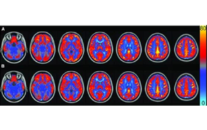 AJCN：要長(zhǎng)壽，常吃豆！長(zhǎng)期食用大豆飲食可讓大腦“更靈光”