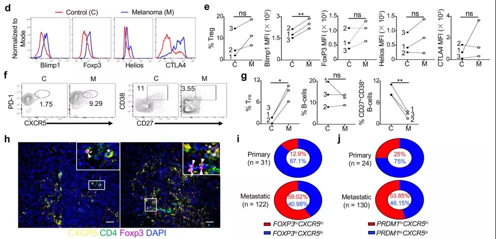 如何重塑腫瘤微環(huán)境，強化抗PD-1療效？Treg細胞的Blimp1表達是關鍵！