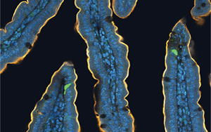 喝完無糖飲料還想吃甜食？人們對(duì)糖的渴望，無法被甜味劑替代，答案都在腸道里！