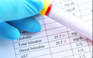 總膽紅素/直接膽紅素檢測一站式解決方案