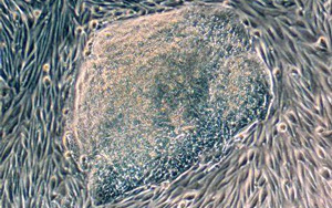 首次發(fā)現(xiàn)人類尿液來源的干細胞具有強大的再生潛力！