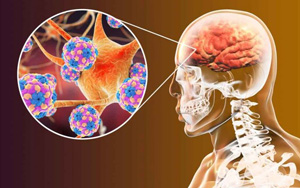 nOPV2的改良疫苗用于全球根除脊髓灰質(zhì)炎全球行動計劃
