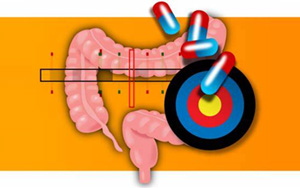 《Nature Genetics》確定10個克羅恩病相關(guān)基因