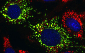 iScience：一種對(duì)抗遺傳性神經(jīng)系統(tǒng)疾病的潛在途徑