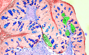 Nature新研究解答爭議，為炎癥性疾病的免疫機制提供新見解
