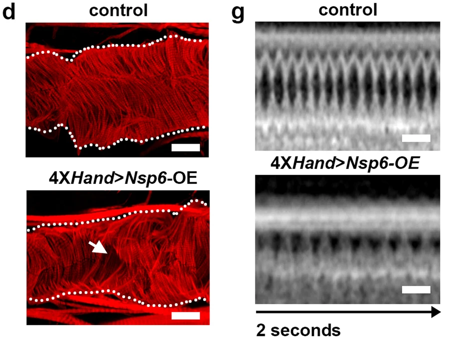 UAS-SARS-CoV-2Nsp6轉(zhuǎn)基因的4XH和Gal4、成纖維細(xì)胞特異性過(guò)表達(dá)（OE）誘導(dǎo)的成人心臟表型