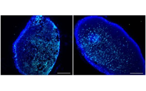 Nature：恢復(fù)活力的免疫細胞能更好地清除大腦中的有毒廢物
