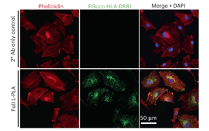食用L-巖藻糖來對(duì)抗黑色素瘤