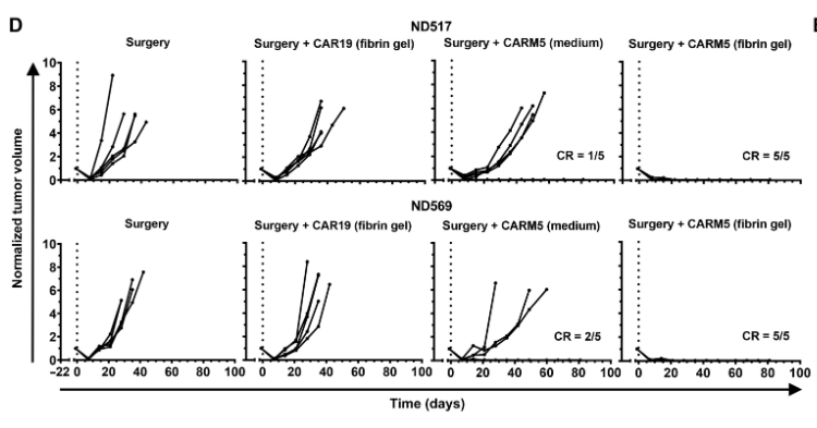 纖維蛋白凝膠中的CAR-T細(xì)胞在TNBC異種移植模型中有效清除術(shù)后殘留腫瘤細(xì)胞