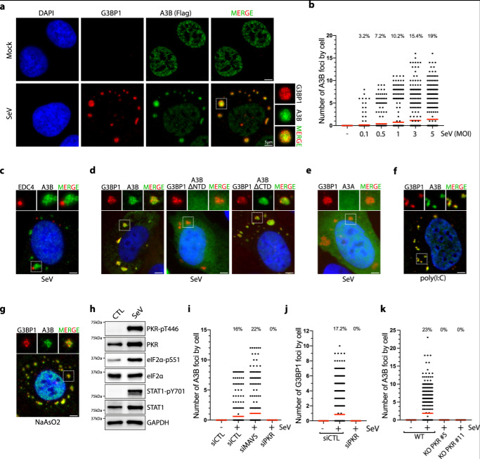 SeV感染誘導(dǎo)APOBEC3B定位于應(yīng)激顆粒