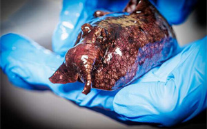 神經(jīng)信號(hào)調(diào)節(jié)新發(fā)現(xiàn)：L-或D-氨基酸？鏡像分子可改變神經(jīng)元的信號(hào)！