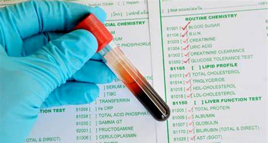 單胺氧化酶（MAO）檢測(cè)