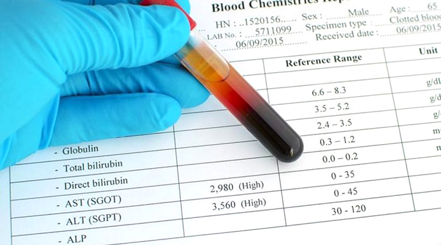 谷丙轉氨酶（ALT）檢測
