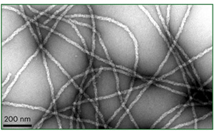 一個高度不穩(wěn)定的蛋白質(zhì)導致神經(jīng)退化