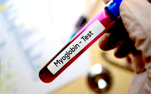 肌紅蛋白（Myo）-磁微?；瘜W(xué)發(fā)光（AE/AP） /熒光免疫層析解決方案