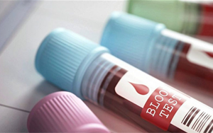 脂聯(lián)素 糖尿病早期篩查的“新指標(biāo)”