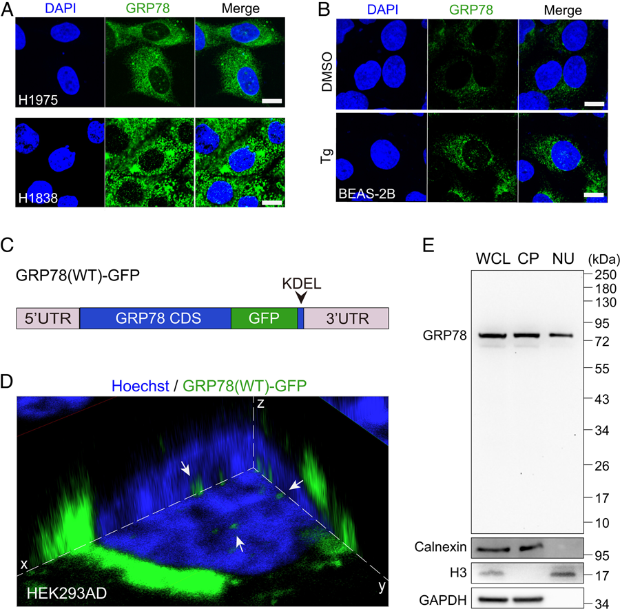 GRP78定位于人癌癥細(xì)胞和內(nèi)質(zhì)網(wǎng)應(yīng)激細(xì)胞的細(xì)胞核。