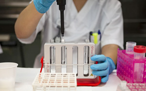 糖鏈抗原19-9(CA19-9)-磁微?；瘜W(xué)發(fā)光（吖啶酯）解決方案