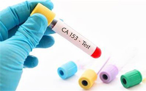 糖類抗原15-3(CA15-3)-磁微?；瘜W(xué)發(fā)光法（AE/AP）解決方案