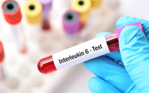 白介素-6（IL-6）-磁微?；瘜W(xué)發(fā)光（吖啶酯） /熒光免疫層析解決方案