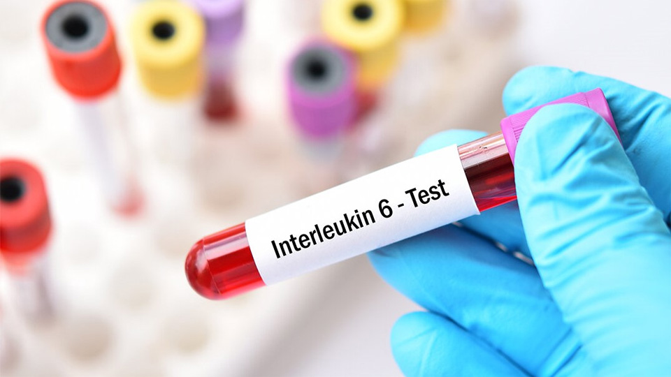 IL-6磁微?；瘜W發(fā)光熒光免疫層析