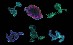 再生醫(yī)學(xué)的未來(lái)，到類器官的世界中去