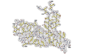 令人驚訝的蛋白質(zhì)導致早期癡呆