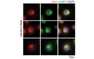 Nature子刊：開創(chuàng)性的將化學探針引入活細胞，靶向紅斑狼瘡