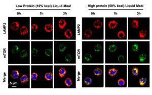 Nature子刊亮氨酸暴露實驗證明高蛋白飲食如何使你的動脈硬化