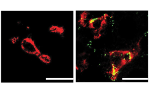 Nature子刊：肝臟中的免疫細(xì)胞會對高膽固醇水平做出反應(yīng)，并吃掉多余的膽固醇