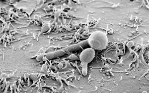 白色念珠菌毒素在消化道定植中起著特殊的作用