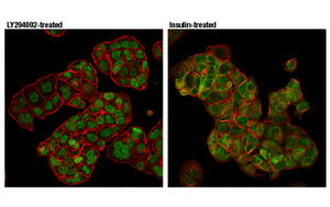 Nature最新發(fā)現(xiàn)控制CAR-T細(xì)胞壽命的蛋白質(zhì)！