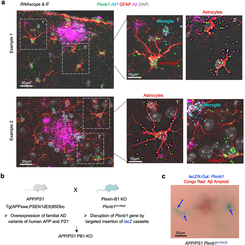 Plexin-B1在APP/PS1小鼠AD模型的斑塊周?chē)切文z質(zhì)細(xì)胞中上調(diào)